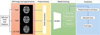 Deep Learning for Differentiating Benign From Malignant Parotid Lesions on MR Images